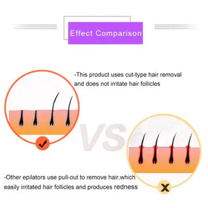 NoorAura™Purple Epilator – آلة إزالة الشعر البنفسجية.