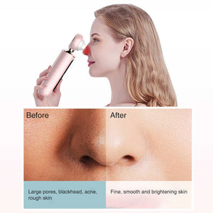 NoorAura™ Blackhead Suction Machine.