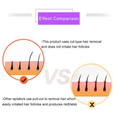 NoorAura™Purple Epilator – آلة إزالة الشعر البنفسجية.