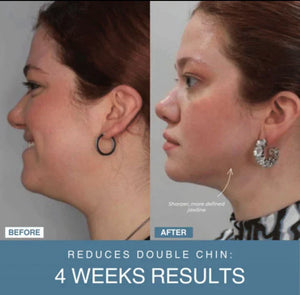 NoorAura™ 7-in-1 LED Anti-Aging/Wrinkle Apparatus.