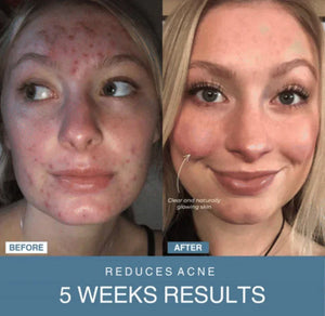 NoorAura™ 7-in-1 LED Anti-Aging/Wrinkle Apparatus.